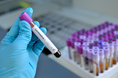 Eine behandschuhte Hand hält ein Probenröhrchen mit einer positiv auf das Coronavirus getesteten Blutprobe. Im Hintergrund sind weitere Probenröhrchen zu sehen.